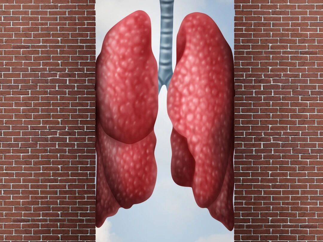 寒冬来袭，慢阻肺患者如何做到呼吸不“卡顿”？