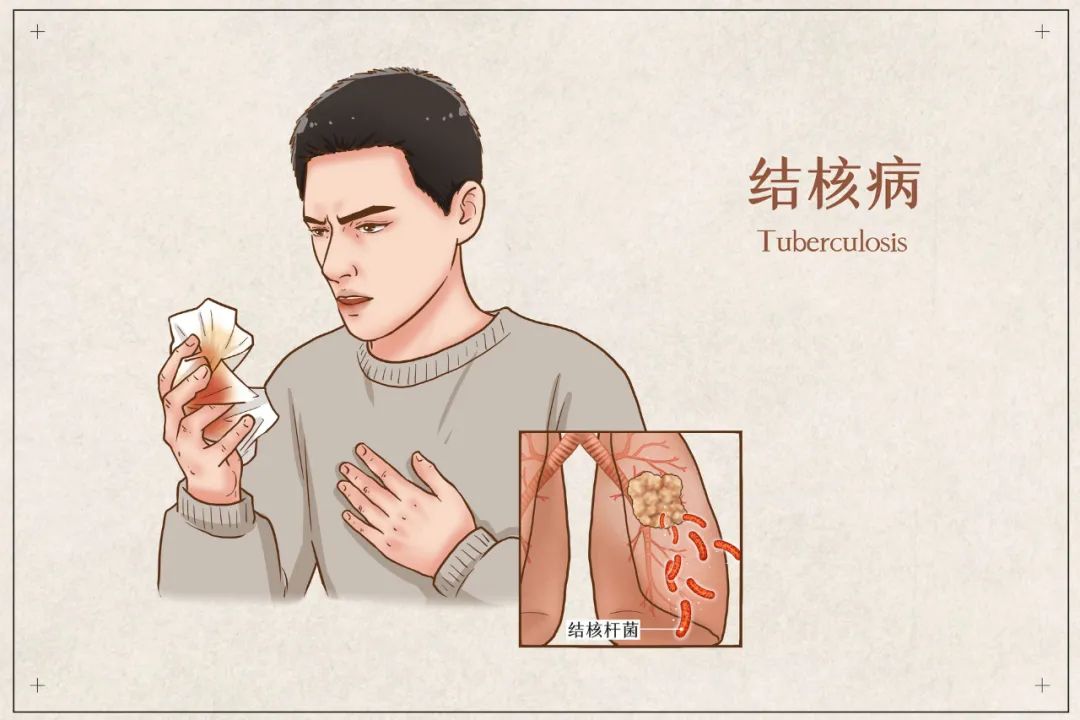 解锁结核知识，共享防控成果！