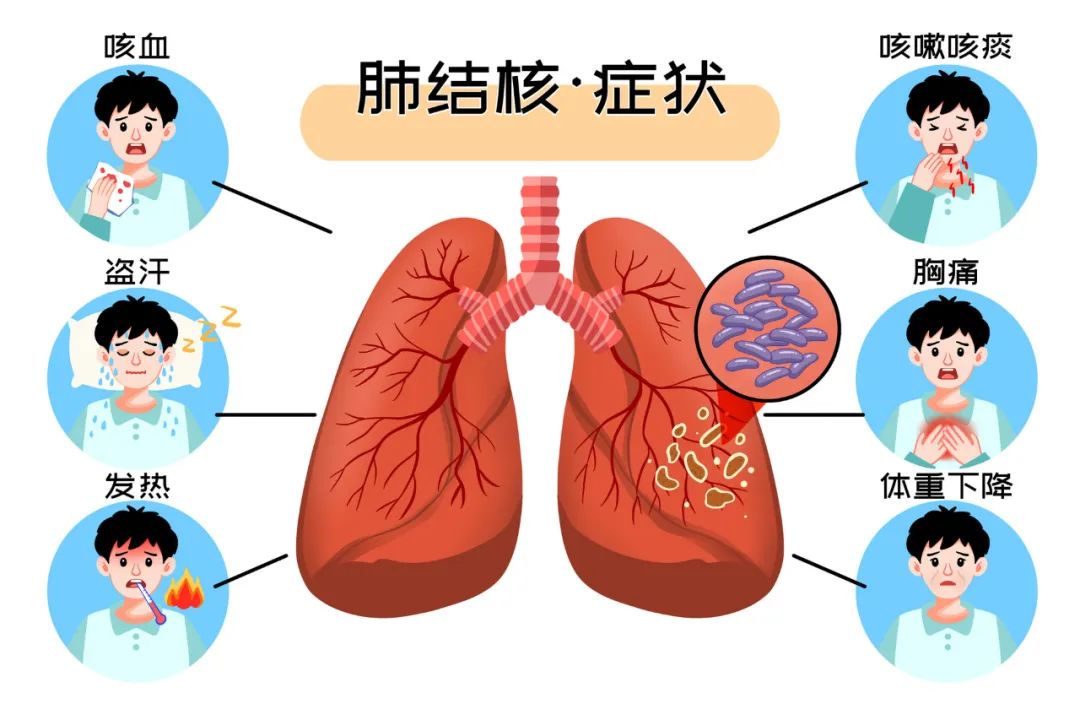 解锁结核知识，共享防控成果！