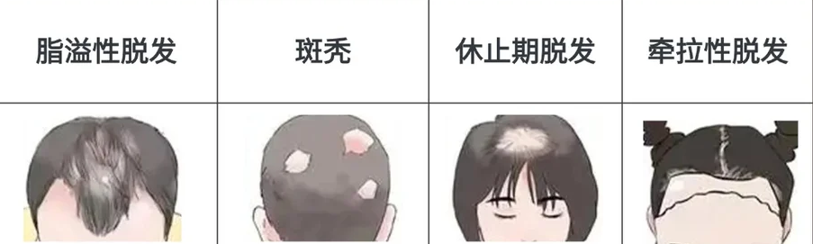 “秃”如其来的真相：为什么你的头发“留不住”了？