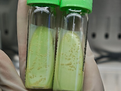 咳嗽两周就是肺结核?看懂这4项实验室检查,再也不白做检查!