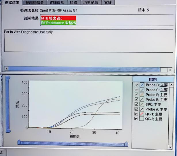 咳嗽两周就是肺结核?看懂这4项实验室检查,再也不白做检查!